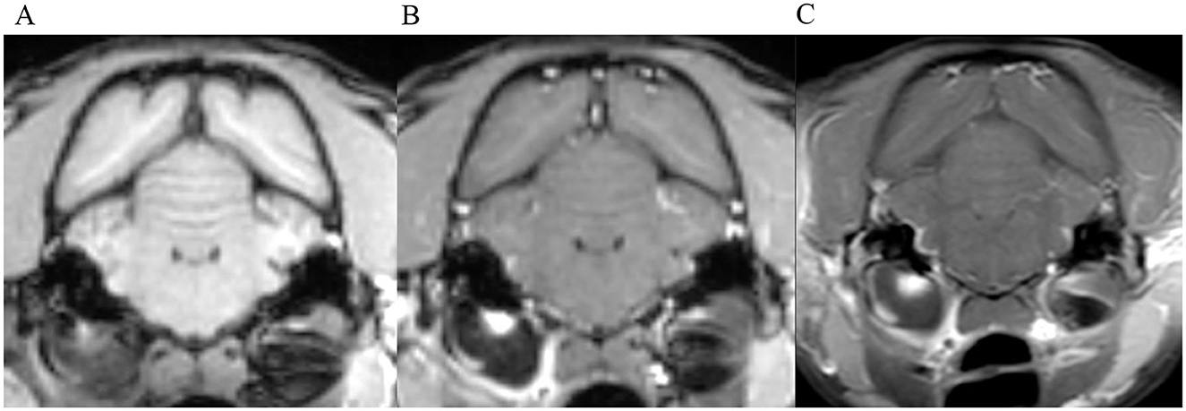 Three MRI images showing axial brain views. The first image shows less detail compared to the others. The second image enhances the clarity of structures. The third image provides the most detailed view, with clearer contrast and visibility of brain features.