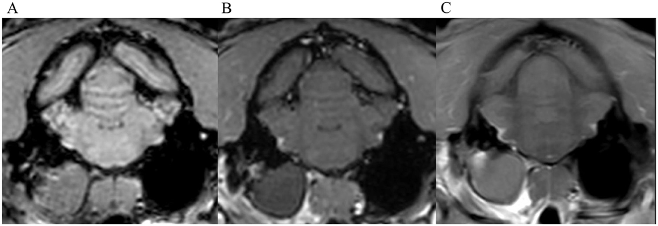 Three MRI scans of a spine are shown side by side, each displaying different contrast levels and anatomical details. The images highlight variations in soft tissue and bone visibility.