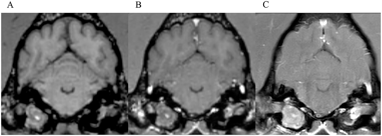 Three MRI scans display horizontal cross-sections of a brain, highlighting details of brain structures in varying levels of focus and contrast. The images show differences in texture and clarity.