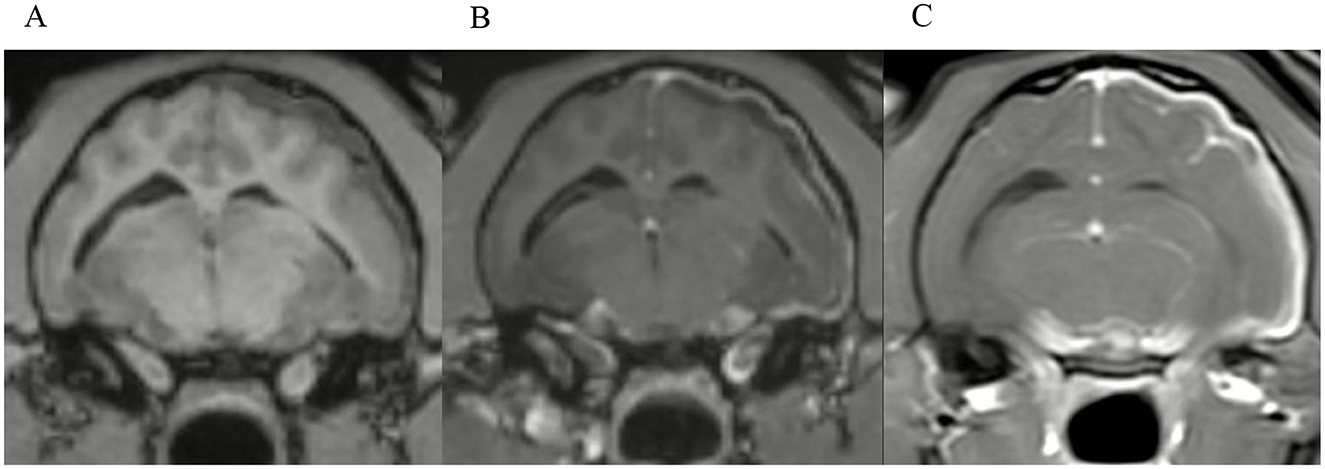 Three MRI brain scans are displayed side by side in a horizontal sequence, showing coronal views. Each image highlights different tissue contrasts likely due to varied MRI settings, with distinguishable gray and white matter regions.