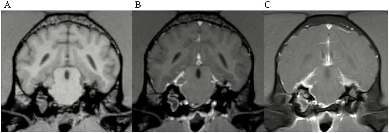 Three coronal MRI brain images side-by-side compare different sections. Each image shows distinct anatomical features, highlighting variations in tissue density and structure.