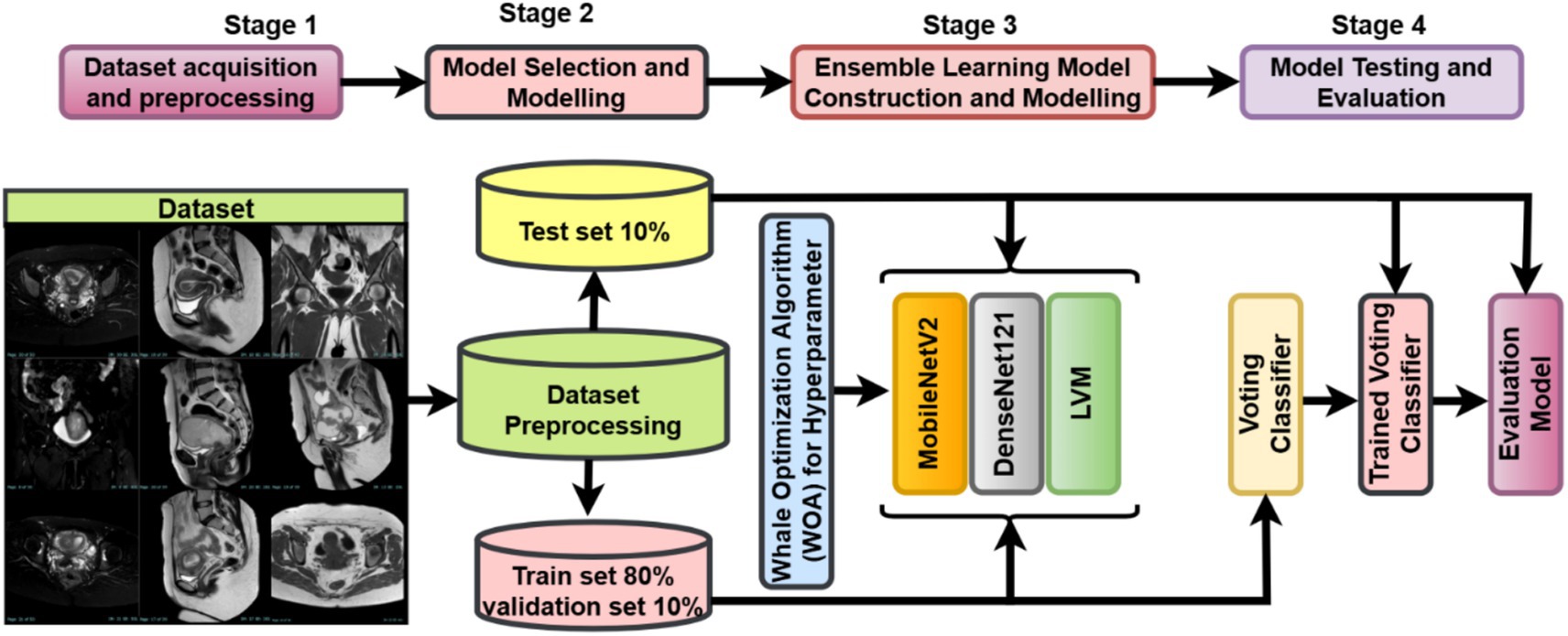 Flowchart depicting a machine learning pipeline for medical imaging analysis. It follows four stages: Dataset acquisition and preprocessing, Model selection and modeling, Ensemble learning model construction, and Model testing and evaluation. Workflow includes dataset splitting, preprocessing, hyperparameter optimization using Whale Optimization Algorithm, model training with MobileNetV2, DenseNet121, and LVM, leading to a voting classifier and evaluation. MRI images are displayed representing the dataset.