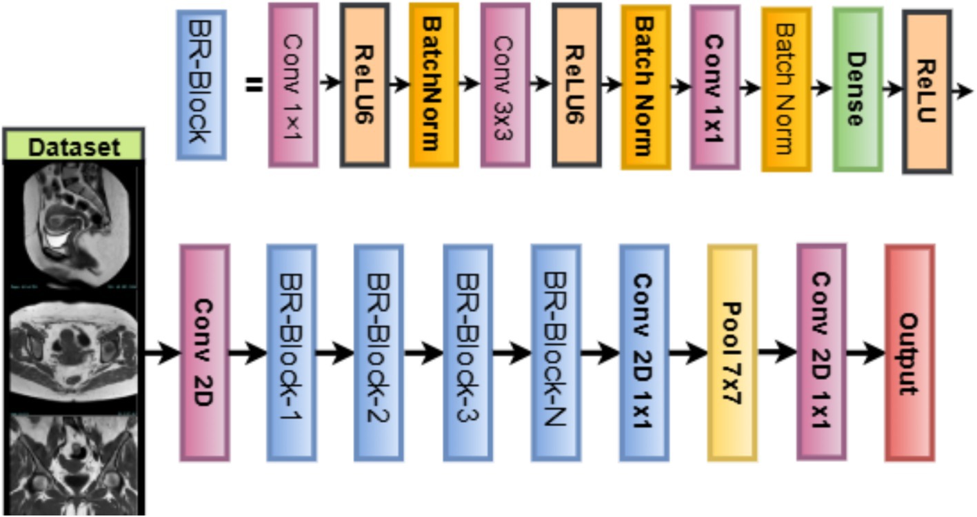 Diagram of a neural network architecture for processing medical images. It starts with a dataset of MRI scans, proceeds through a Conv2D layer, followed by a series of BR-Blocks. The sequence continues with multiple convolutional layers, batch normalization, ReLU activation, and pooling, ending with a final output layer.