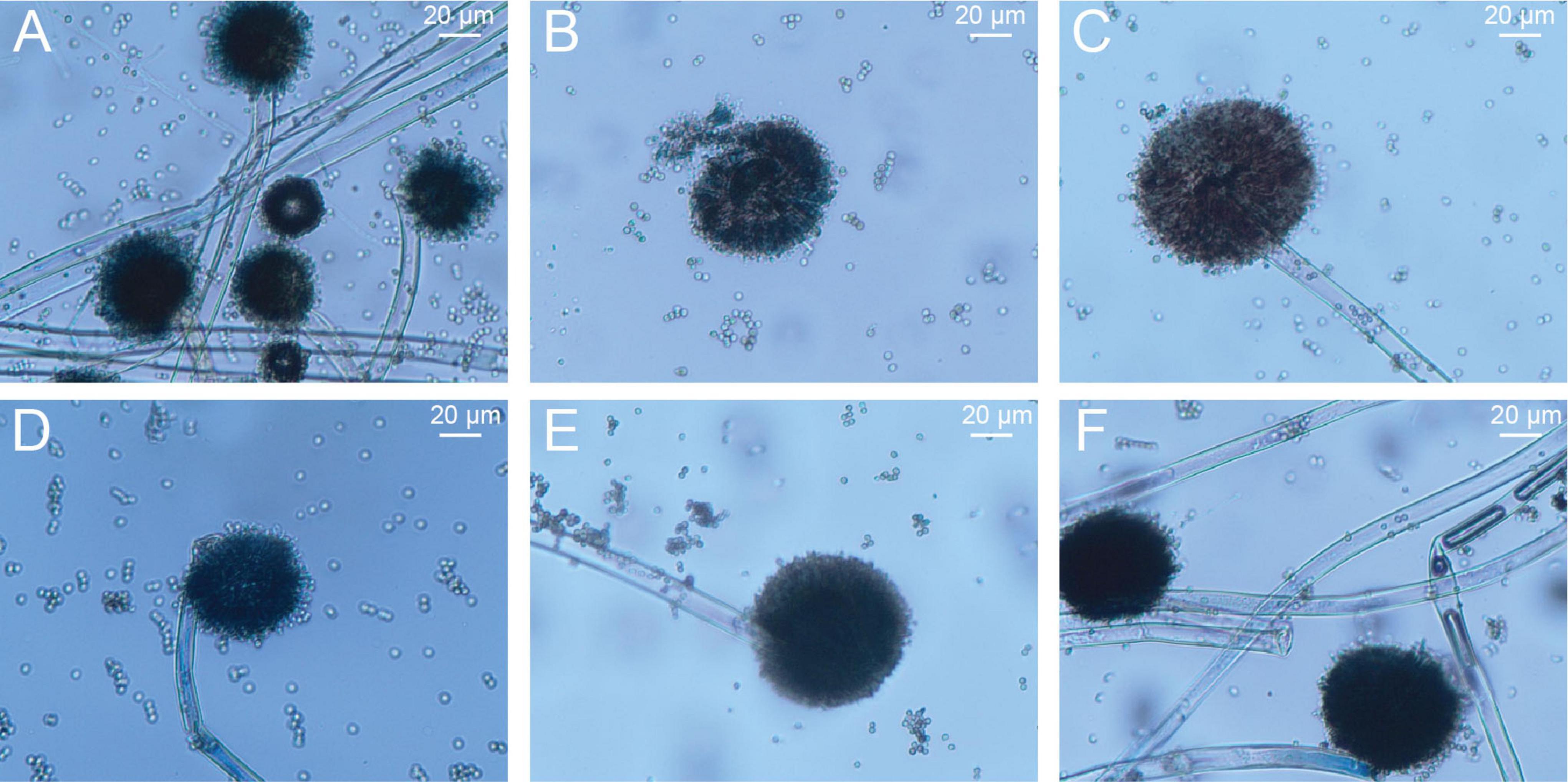 Microscopic images labeled A to F show fungal spores and hyphae at 20 micrometers scale. Each panel displays clusters of dark, spherical spores attached to thin, translucent hyphae against a light blue background.