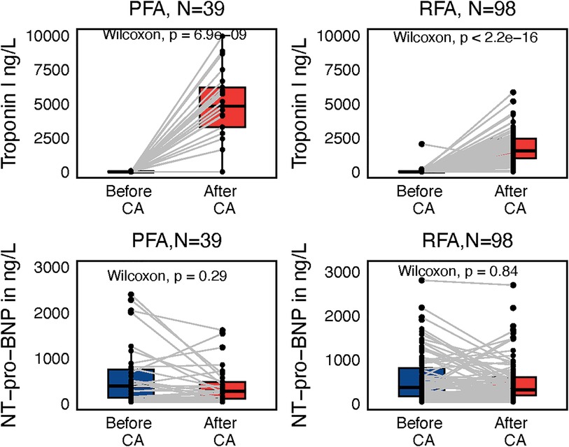 Four box plots illustrating Troponin I and NT-pro-BNP levels before and after two procedures, PFA and RFA, with significant increases in Troponin I for both procedures (p < 0.05) and no significant change in NT-pro-BNP.