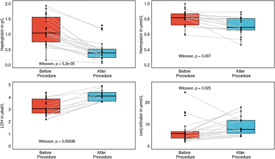 Four box plots showing changes in blood parameters before and after a procedure. Top left: Haptoglobin levels decrease significantly (p = 5.2e-05). Top right: Hemopexin levels show a decrease (p = 0.007). Bottom left: LDH levels decrease significantly (p = 0.00038). Bottom right: Conjugated bilirubin levels increase (p = 0.025).