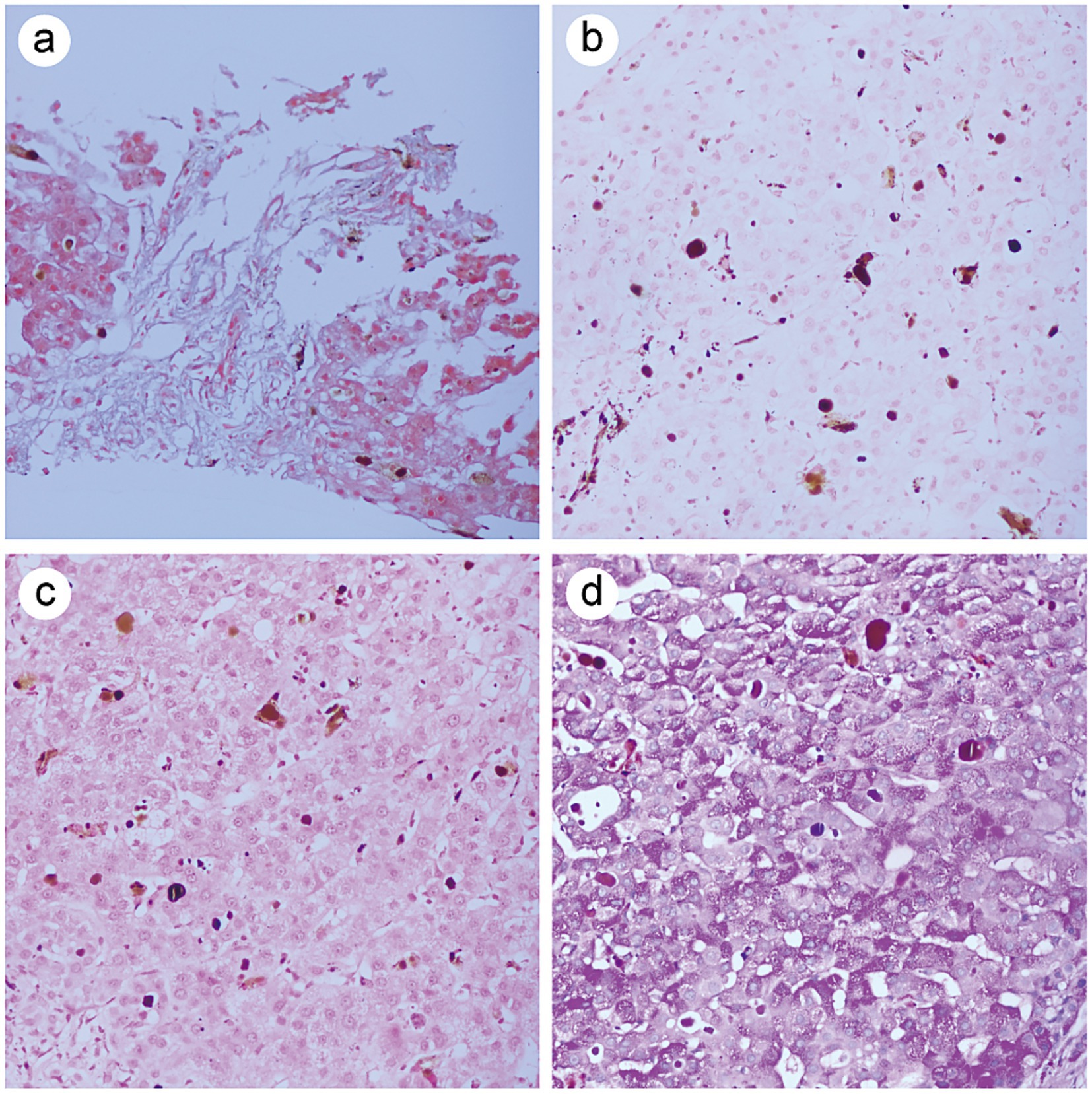 Four panel image showing histological sections under a microscope. (a) Displays a fibrous structure with pink and red staining. (b) Shows a lighter pink background with scattered darker spots. (c) Presents numerous small, dark particles within a pink matrix. (d) Displays a dense array of round, purple-stained structures.