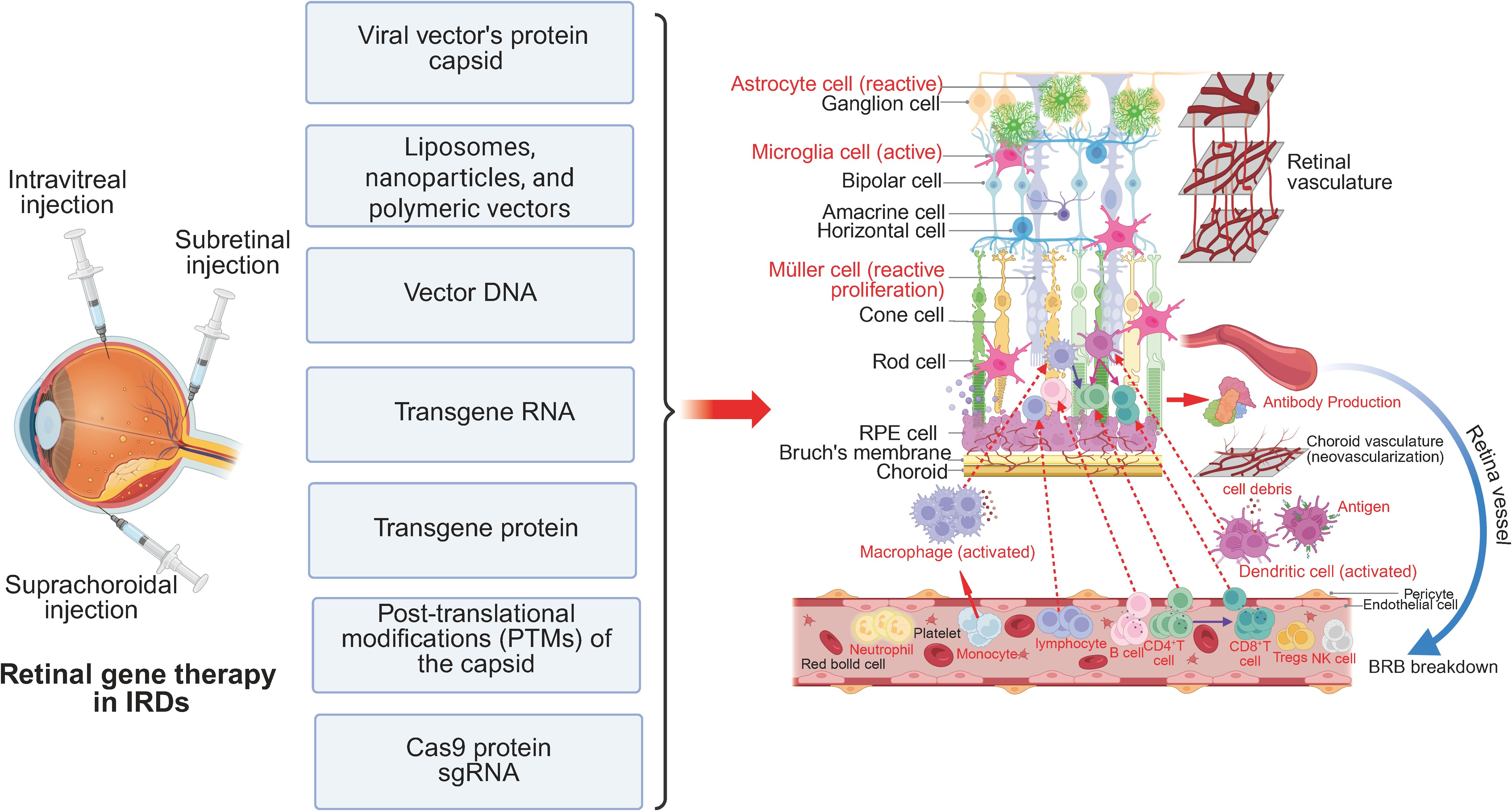 Diagram of retinal gene therapy in inherited retinal diseases (IRDs) showing injection methods: intravitreal, subretinal, and suprachoroidal. It outlines therapy components like viral vector's capsid, vectors, transgene RNA/protein, and Cas9 protein. The diagram illustrates cellular interactions in the retina, including reactive astrocyte, microglia, and Müller cells, and associated responses such as antibody production and vasculature changes, highlighting the complex retinal structure and potential therapeutic targets.