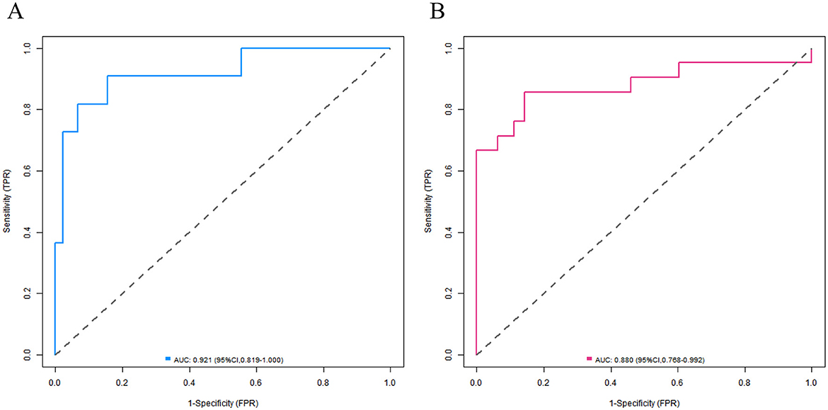 Two ROC curve graphs labeled A and B. Graph A features a blue curve with an AUC of 0.921 and a confidence interval of 0.819-1.000. Graph B features a pink curve with an AUC of 0.880 and a confidence interval of 0.768-0.992. Both graphs plot sensitivity versus one minus specificity, with a dashed diagonal line representing random chance.