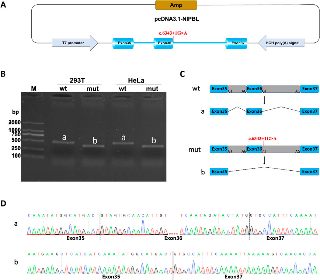 Diagram showing a vector map and genetic analysis. Panel A illustrates the pcDNA3.1-NIPBL vector with exons 35, 36, and 37, highlighting mutation c.6343+1G>A. Panel B shows gel electrophoresis results with lanes for 293T and HeLa cells, labeled