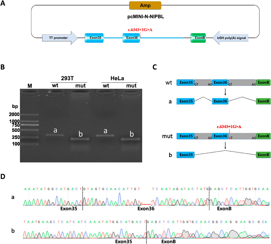 Diagram illustrating a genomic study. Panel A displays a plasmid vector diagram with labeled exons, a T7 promoter, and a point mutation (c.6343+1G>A). Panel B shows a gel electrophoresis result distinguishing wild-type (wt) and mutant (mut) samples from 293T and HeLa cells, with labeled lanes showing bands a and b. Panel C features diagrams of normal and mutant splicing, highlighting the mutation's effect on exon connectivity. Panel D presents sequencing chromatograms for bands a and b, indicating exon boundaries and nucleotide changes.