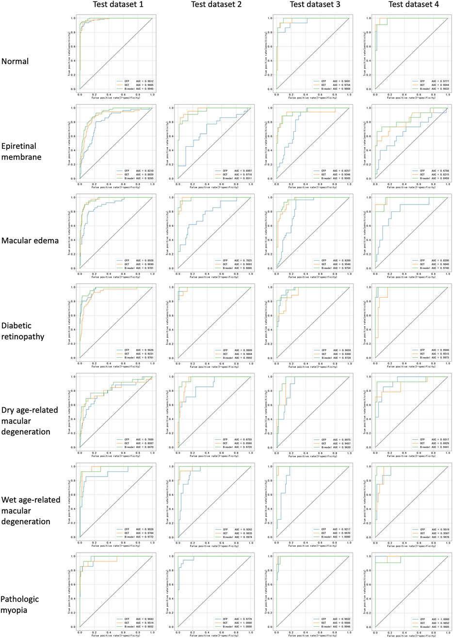 Receiver Operating Characteristic (ROC) curves for seven eye conditions across four test datasets, labeled as Test datasets 1 to 4. Each row represents a condition: Normal, Epiretinal membrane, Macular edema, Diabetic retinopathy, Dry age-related macular degeneration, Wet age-related macular degeneration, and Pathologic myopia. The graphs compare classifiers (GPT, Arc, Res) with Area Under the Curve (AUC) values noted. The diagonal line represents random chance.