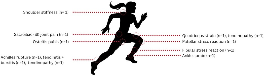 Silhouette of a running person with red dotted lines pointing to different body parts, indicating injuries such as shoulder stiffness, sacroiliac joint pain, and osteitis pubis. Additional injuries include quadriceps strain, patellar stress reaction, fibular stress reaction, and ankle sprain. Achilles issues and tendinopathy are also noted.