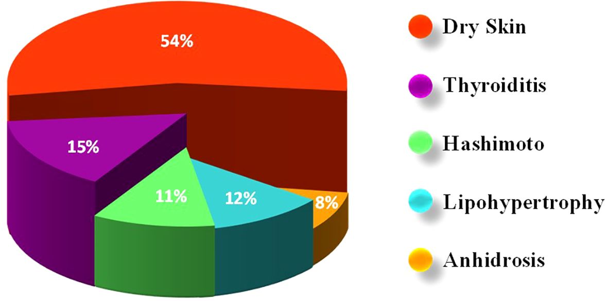 3D pie chart showing skin conditions: Dry Skin (54%, red), Thyroiditis (15%, purple), Hashimoto (11%, green), Lipohypertrophy (12%, light blue), Anhidrosis (8%, orange). Labels with corresponding colors.