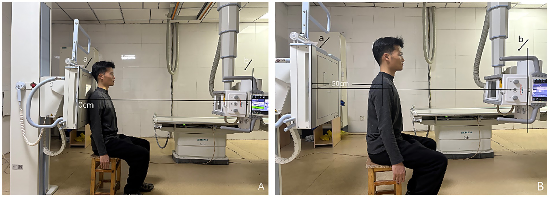 Two side-by-side images present a person in a medical setting with X-ray equipment. In image A, the person is seated close to the machine, labeled at