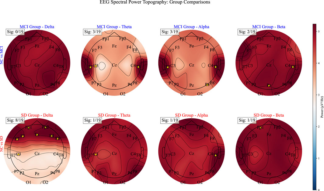 Eight circular diagrams represent EEG spectral power topography for MCI and SD groups across Delta, Theta, Alpha, and Beta frequencies. Each diagram is labeled with significance levels, channel positions, and color-coded power scales, indicating different brain activity levels.