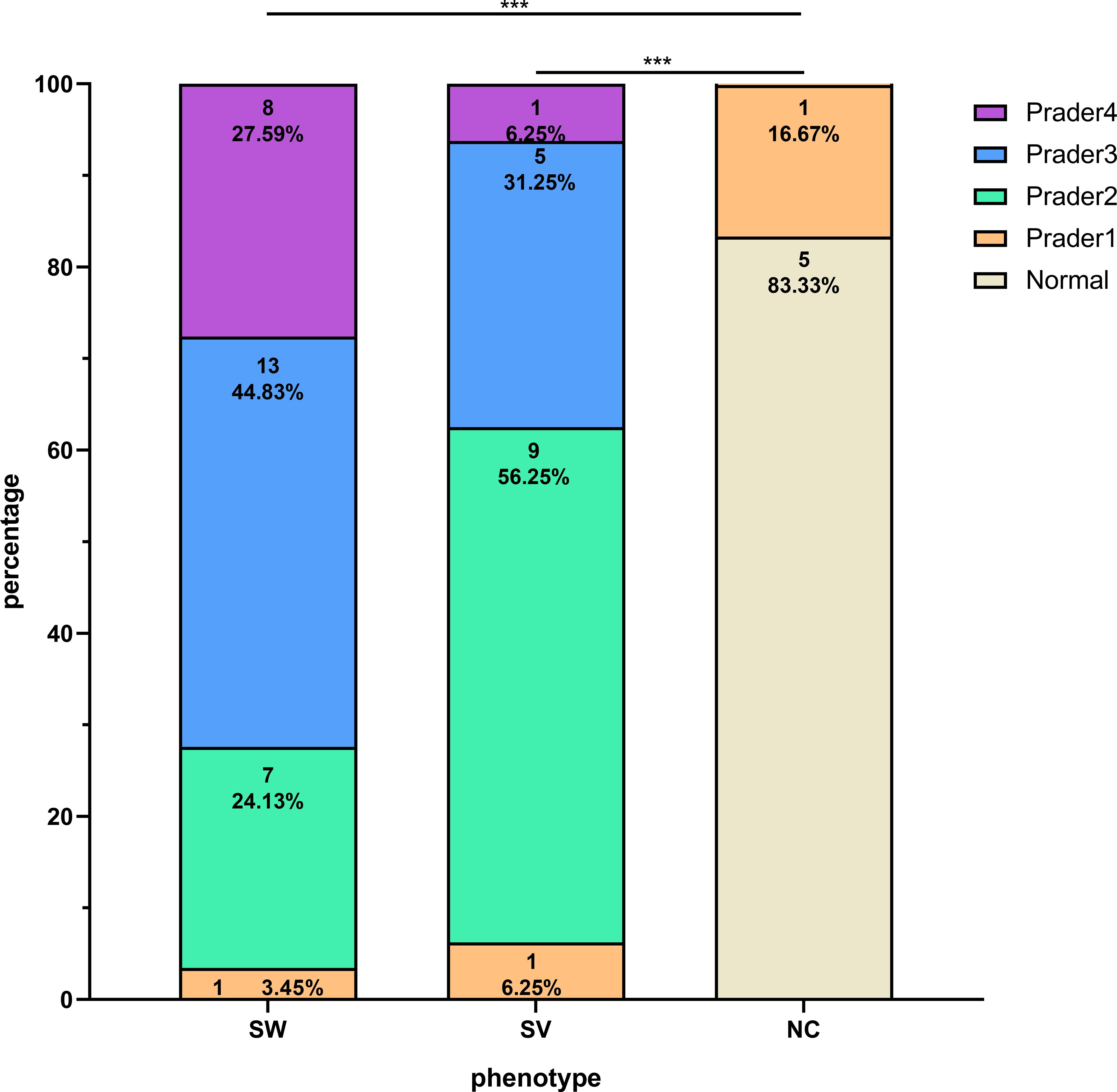 Bar chart showing the percentage distribution of phenotypes SW, SV, and NC across different Prader types. SW (n=29): Prader4 27.59%, Prader3 44.83%, Prader2 24.13%, Prader1 3.45%. SV (n=16): Prader4 6.25%, Prader3 31.25%, Prader2 56.25%, Prader1 6.25%. NC (n=6): normal 83.33%, Prader4 16.67%. Statistical significance is indicated by asterisks.