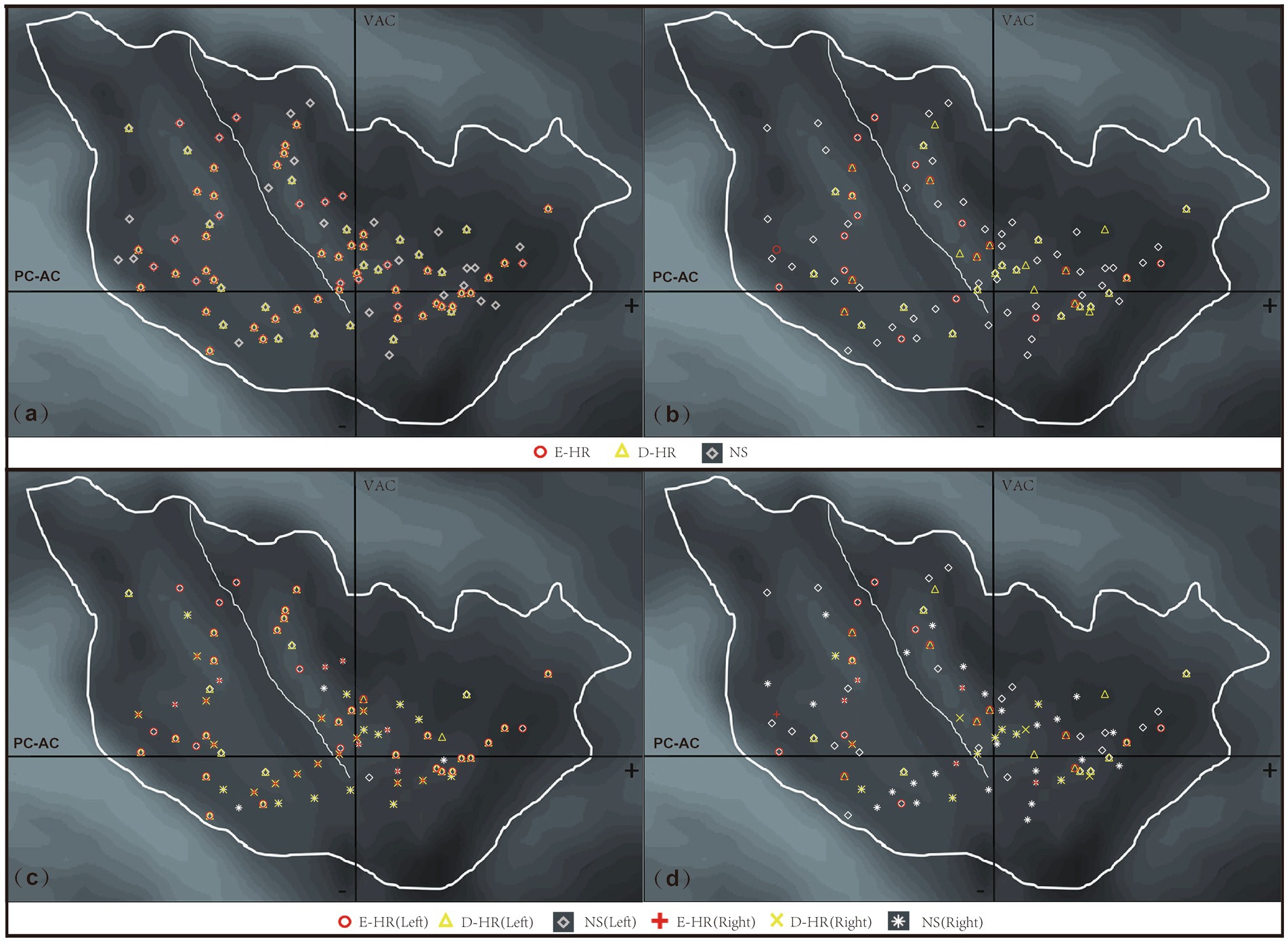 Four panel diagram showing regions with marked points, each panel labeled (a) to (d). Points are color-coded and shaped to indicate E-HR, D-HR, and NS values. Panels depict contours with labels PC-AC and VAC. A legend indicates symbols for each value type, with differences in panels (c) and (d) showing left and right side labeling for E-HR, D-HR, and NS.
