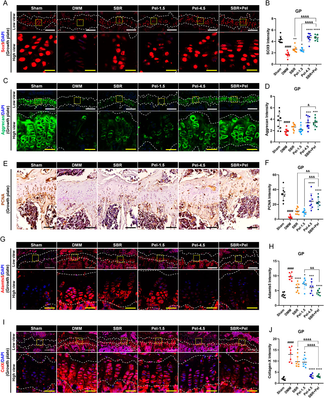 Composite image showing histological analyses and graphs across different treatments: (A) Sections labeled with SOX9 and DAPI indicating cellular presence. (B) Graph of SOX9 intensity with statistical annotations. (C) Sections showing Aggrecan and DAPI labeling. (D) Graph of Aggrecan intensity. (E) Sections with PCNA staining for proliferation analysis. (F) Graph of PCNA intensity.(G) Sections labeled for ADAMTS5 and DAPI. (H) Graph of Actin alpha-SMA intensity.(I) Sections showing Collagen X and DAPI labeling. (J) Graph of Collagen X intensity.Dashed lines and yellow boxes indicate areas of interest. Statistical markers displayed on graphs.