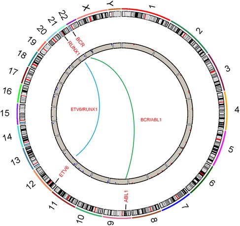Circular diagram depicting chromosomal translocations associated with BCR/ABL1 and ETV6/RUNX1 gene fusions. The outer ring shows numbered chromosomes with banding patterns. Inner lines connect translocation points on chromosomes seven, nine, twelve, and twenty-two.