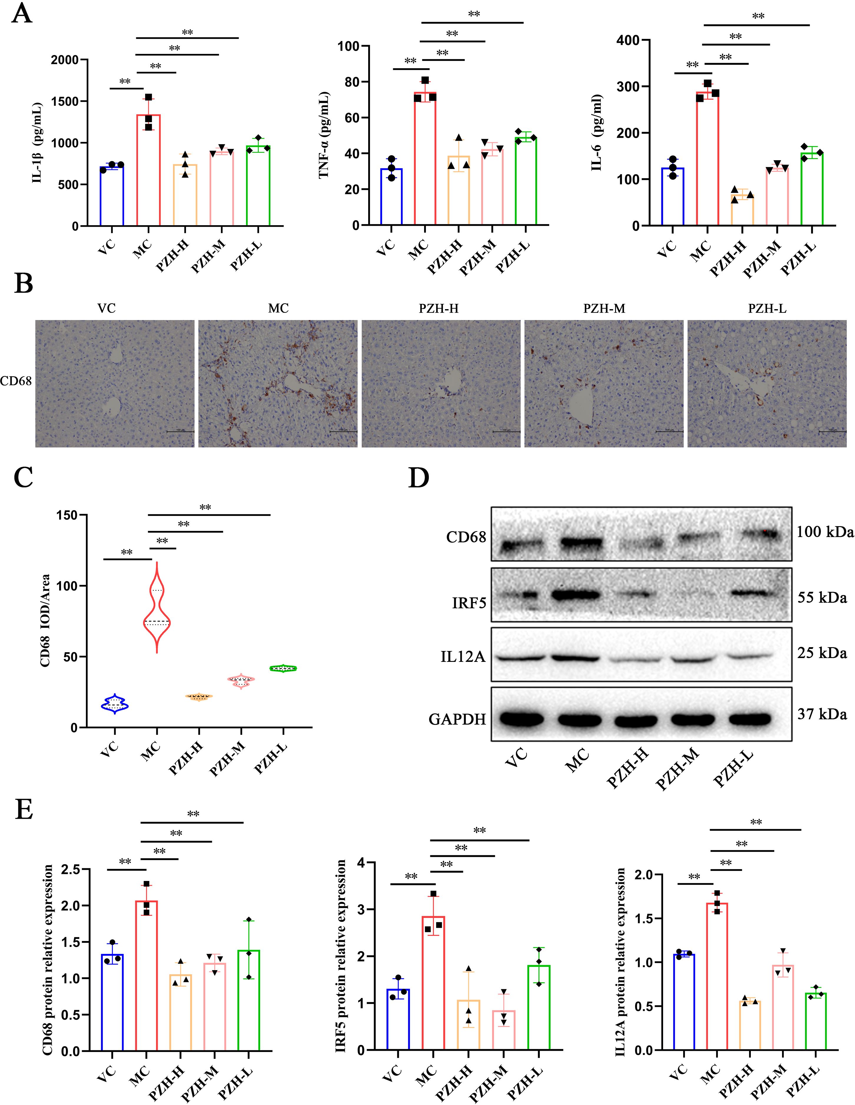 Graphs, images, and a western blot analysis are presented to compare various groups labeled VC, MC, PZH-H, PZH-M, and PZH-L. Panel A shows bar graphs for cytokine levels of IL-1β, TNF-α, and IL-6. Panel B includes histological images stained for CD68. Panel C features a violin plot for CD68 IOD/area. Panel D displays western blot bands for CD68, IRF5, IL12A, and GAPDH. Panel E contains bar graphs for the relative expression of CD68, IRF5, and IL12A proteins. Significant differences are marked with asterisks.