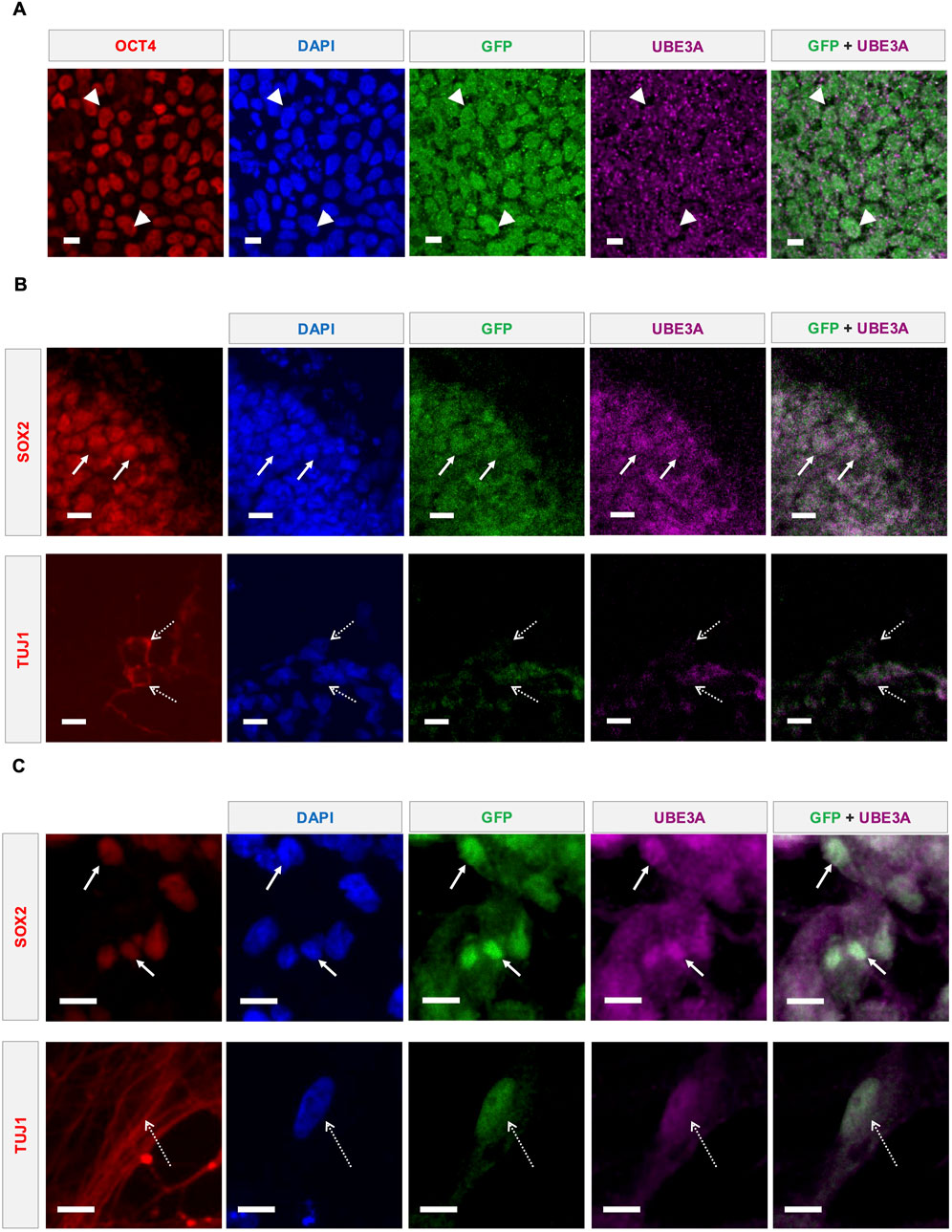 Panel A shows fluorescence-stained pluripotent stem cells with OCT4 in red. DAPI in blue, GFP in green, UBE3A in magenta, and a combined GFP + UBE3A image. Panel B depicts two rows; the top with SOX2 and the bottom with TUJ1 stained cells in the same color scheme. Panel C displays magnified images of SOX2 and TUJ1 stained cells following the same format. Arrowheads and arrows highlight specific areas in each image. Scale bars are present.
