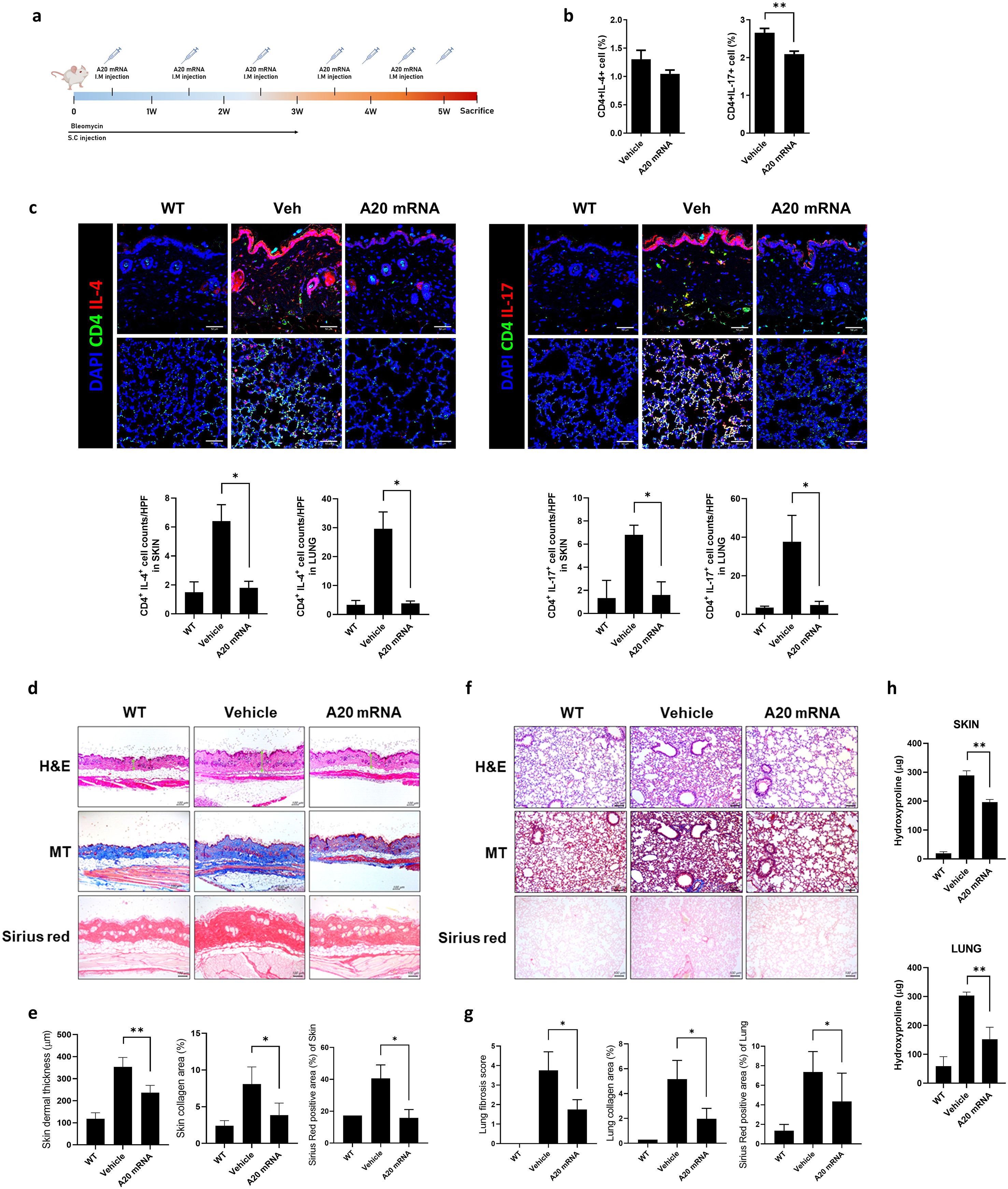 Illustration showing experimental data on A20 mRNA's effects, including schedules, immunofluorescence images, and histological slides of wild-type, vehicle, and A20 mRNA treatments. Graphs display cell counts, skin thickness, lung fibrosis, and hydroxyproline levels with statistical significance marks.