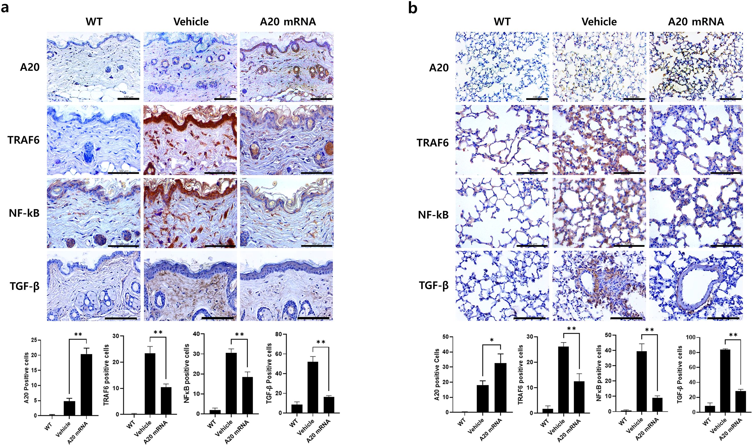 Panel A shows histological images of skin tissue samples and Panel B shows lung tissue samples for WT, Vehicle, and A20 mRNA conditions. Rows represent staining for A20, TRAF6, NF-kB, and TGF-β proteins. Bar graphs below each panel display corresponding quantitative analyses, highlighting significant differences in protein expression across conditions. Scalebars are included in images.