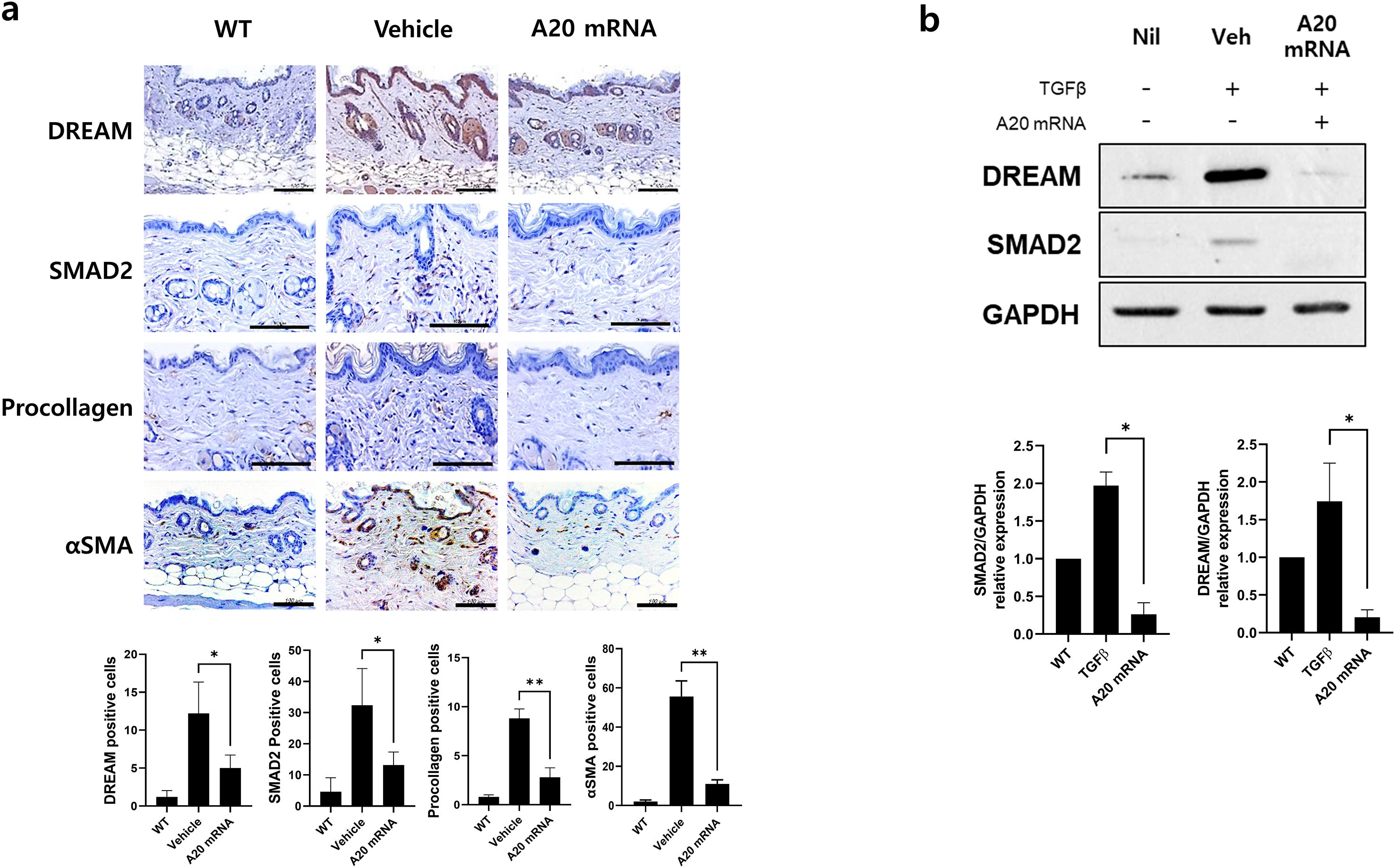 Panel a shows histological sections stained for DREAM, SMAD2, Procollagen, and αSMA, comparing WT, Vehicle, and A20 mRNA conditions. Bar graphs indicate positive cell counts, with significant differences marked by asterisks. Panel b presents Western blot results for DREAM, SMAD2, and GAPDH, under Nil, Vehicle, and A20 mRNA conditions, with bar graphs showing relative expression levels.