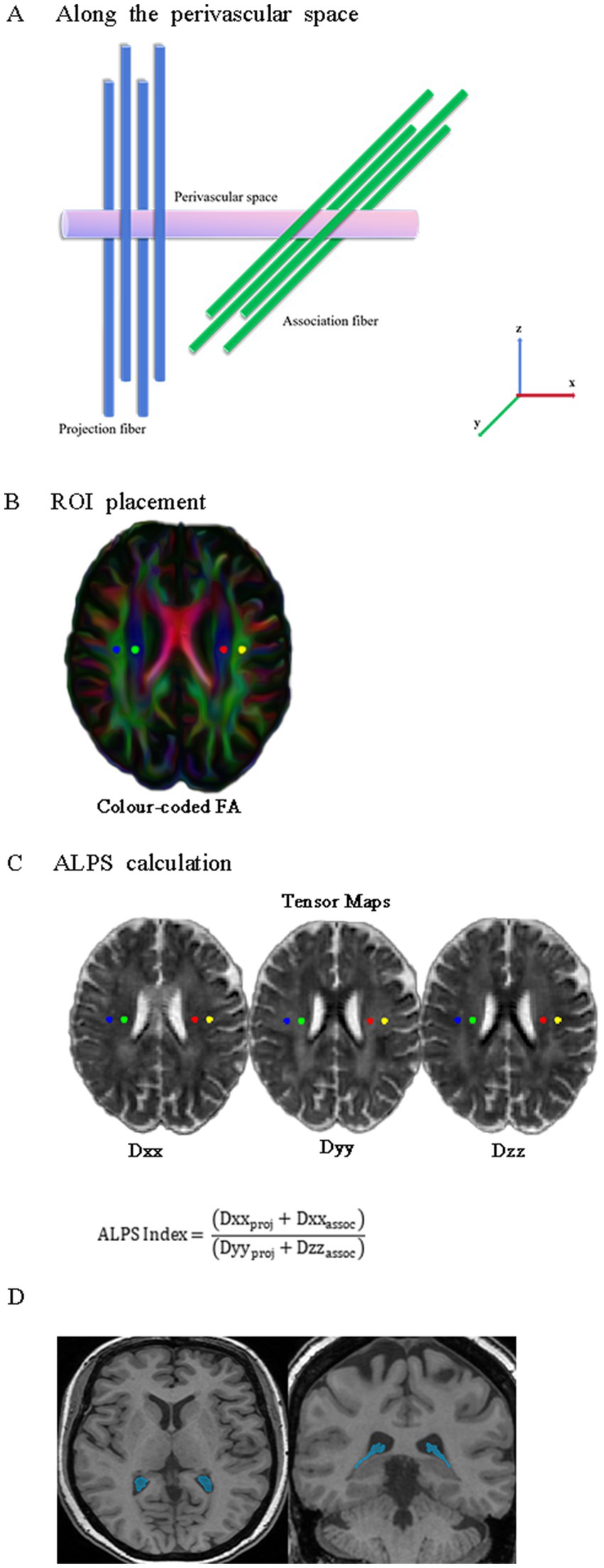 Diagram with four parts: A shows fibers along the perivascular space. B illustrates color-coded fractional anisotropy map with ROI placements. C displays tensor maps (Dxx, Dyy, Dzz) and the ALPS index formula. D presents brain MRI slices with highlighted structures in blue.