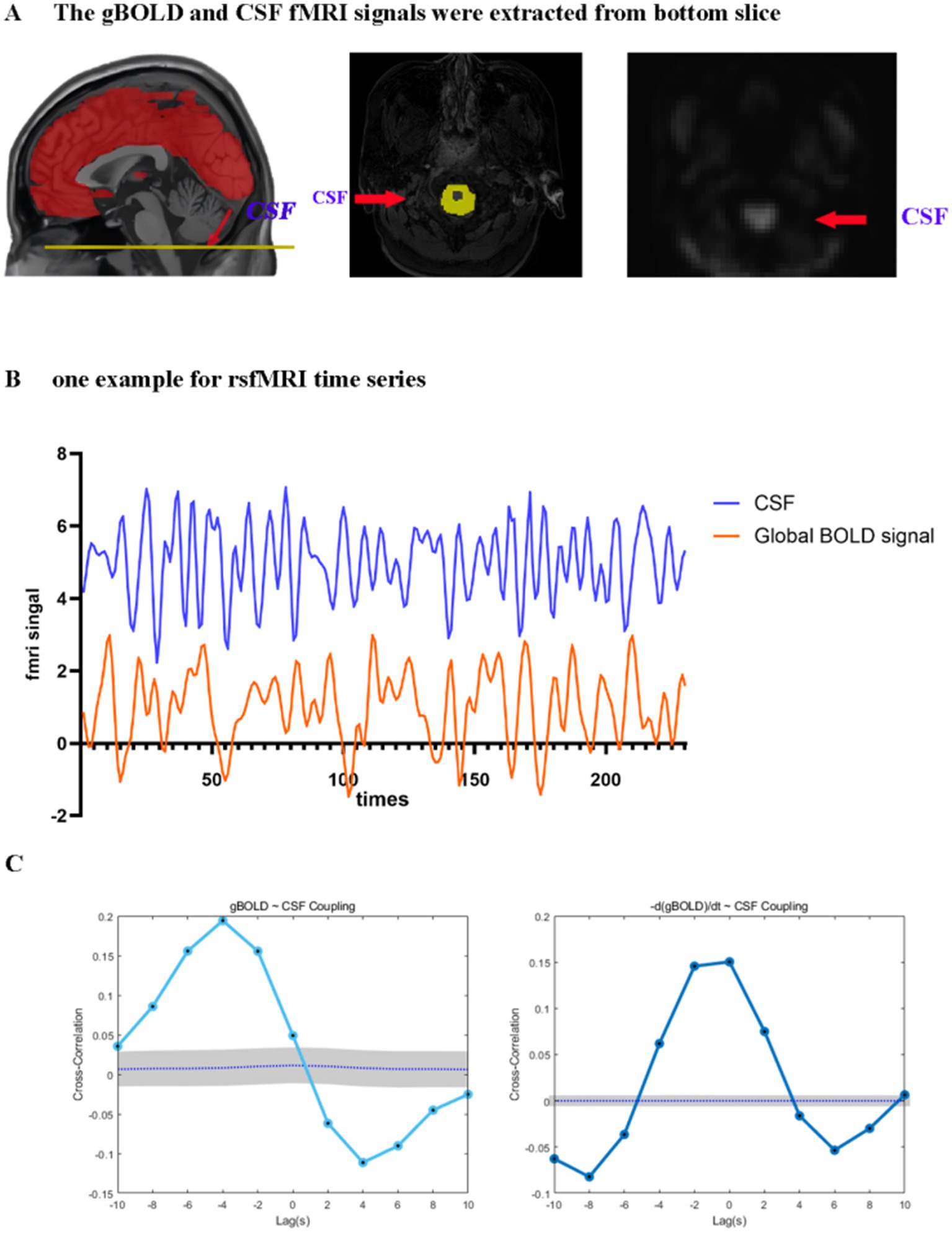 A composite image shows three panels. Panel A includes three brain scan images, highlighting regions where gBOLD and CSF fMRI signals were extracted, with arrows pointing to the highlighted areas. Panel B presents a graph illustrating rsfMRI time series data with CSF and Global BOLD signals plotted over time. Panel C includes two graphs showing gBOLD-CSF coupling and its derivative, each displaying cross-correlation values against time lags.