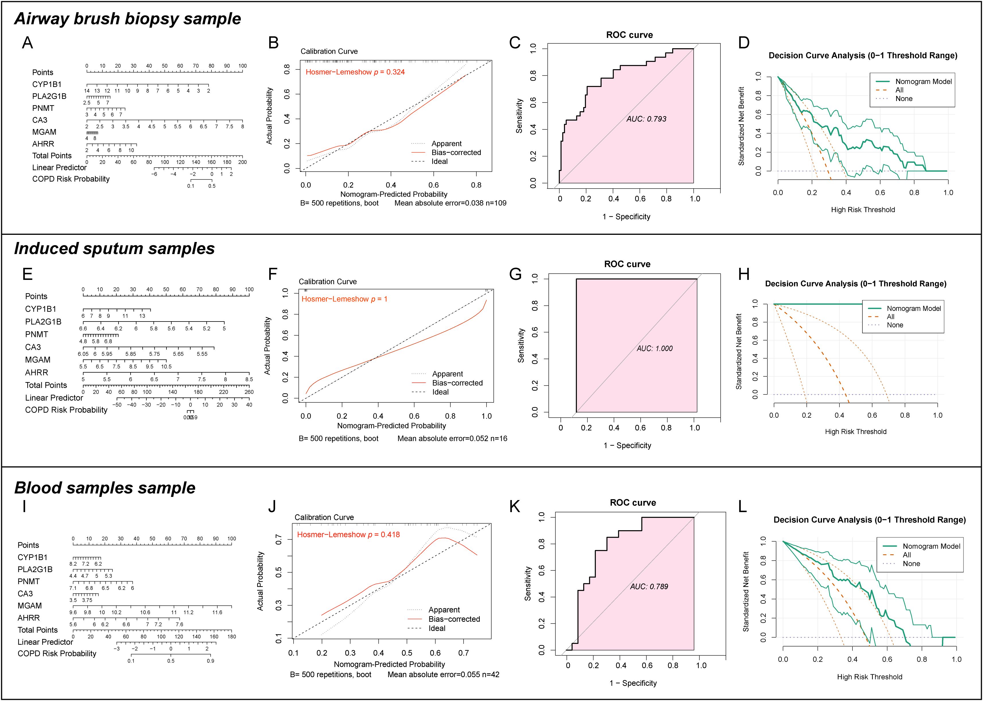 Graphical comparison of models for predicting COPD risk based on different sample types: airway brush biopsy, induced sputum, and blood. Each type includes a nomogram (A, E, I), calibration curve (B, F, J), ROC curve (C, G, K), and decision curve analysis (D, H, L). AUC values are 0.793 for airway brush, 1.000 for induced sputum, and 0.789 for blood. Calibration curves show predicted versus actual probabilities, while decision curves demonstrate net benefit across risk thresholds.