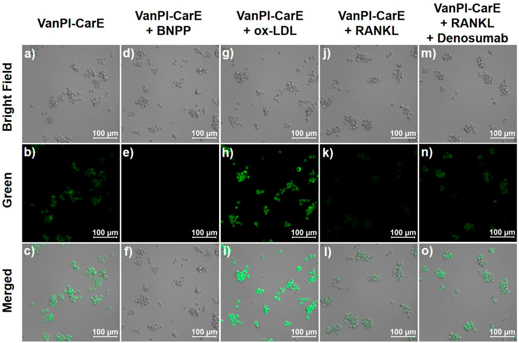 Bright field, green, and merged images showing VanPI-CarE cells under different conditions: untreated (a-c), with BNPP (d-f), with ox-LDL (g-i), with RANKL (j-l), and with RANKL plus Denosumab (m-o). Bright field images (a, d, g, j, m) display cell clusters. Green fluorescence images (b, e, h, k, n) show varying green signal intensities. Merged images (c, f, i, l, o) overlay bright field and fluorescence, highlighting differences in green signal distribution across conditions. Scale bars show 100 micrometers.