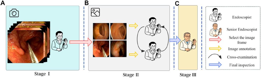 Flowchart of a three-stage endoscopy image analysis process. Stage I shows an endoscopist capturing images. Stage II involves selecting and annotating frames, with cross-examination between two endoscopists. Stage III involves final inspection by a senior endoscopist. Arrows indicate the process flow.