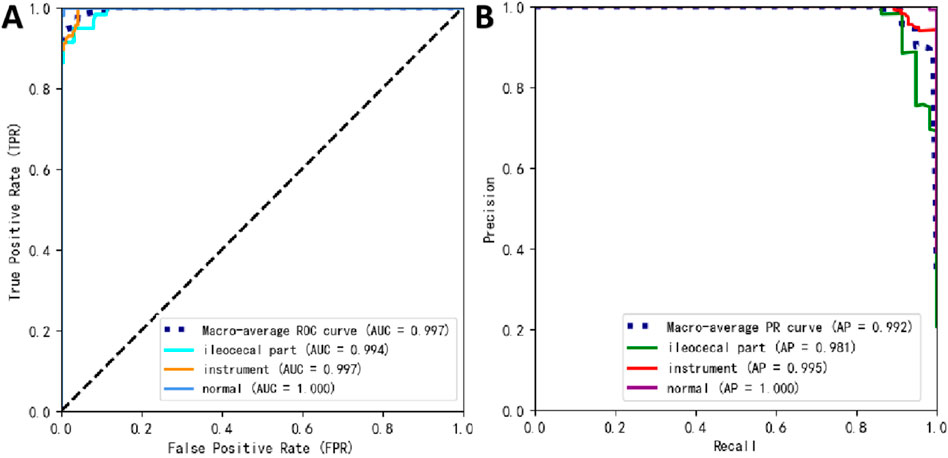 Graph A displays a Receiver Operating Characteristic (ROC) curve with true positive rate vs. false positive rate, showing macro-average, ileocecal part, instrument, and normal categories. Area Under Curve (AUC) values range from 0.994 to 1.000. Graph B shows a Precision-Recall (PR) curve with precision vs. recall for the same categories. Average Precision (AP) values range from 0.981 to 1.000. Both graphs illustrate high performance.