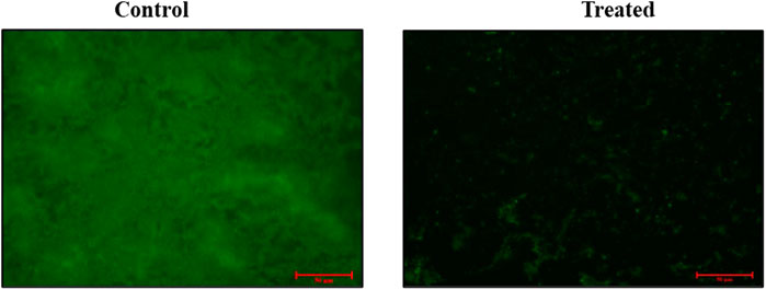 Two fluorescent microscopy images labeled