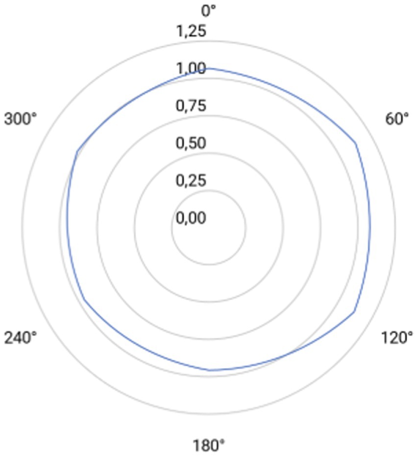 Polar plot of halometric measurements taken at six meridians (0°, 60°, 120°, 180°, 240° and 300°). Concentric circles indicate radial increments of 0.25 mm (from 0.00 to 1.25 mm). Light-blue line rappreen the post-implantation mean halometric radius at each meridian.