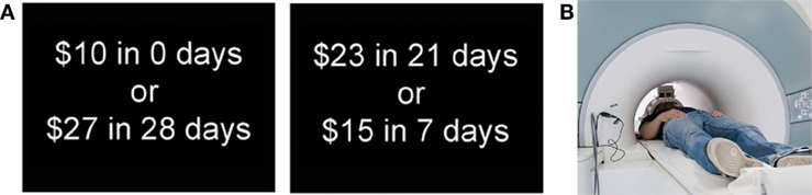 Figure 1 - A. These are two examples of the choices in our study of what is going on in the teenage brain when teenagers have to choose between immediate and delayed rewards.