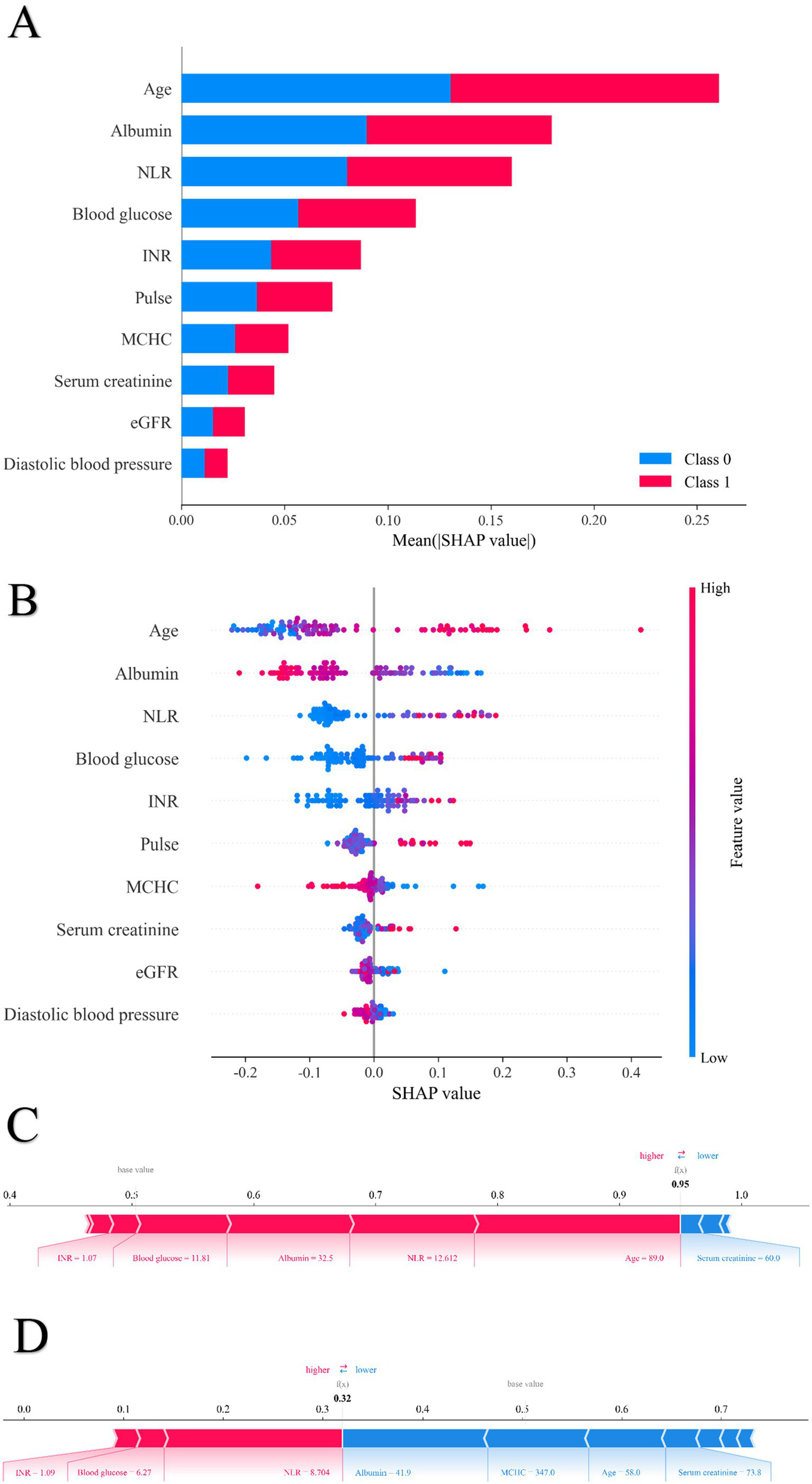 Image A: Bar chart showing the mean SHAP values for different features, such as age, albumin, and NLR, for two classes. Class 0 is in blue, and Class 1 is in red.Image B: Scatter plot illustrating SHAP values for various features like age, albumin, and NLR. Each dot represents a feature value, color-coded from low (blue) to high (red). Graphical visualization of medical parameters with diagrams labeled C and D. Diagram C shows parameters influencing a higher base value: INR 1.07, Blood glucose 11.81, Albumin 32.5, NLR 12.612, Age 89, and a lower Serum creatinine 60.0. Diagram D shows parameters influencing a lower base value: INR 1.09, Blood glucose 6.27, NLR 8.704, and higher Albumin 41.9, MCHC 347.0, Age 58.0, Serum creatinine 73.8. Red indicates higher and blue indicates lower values.