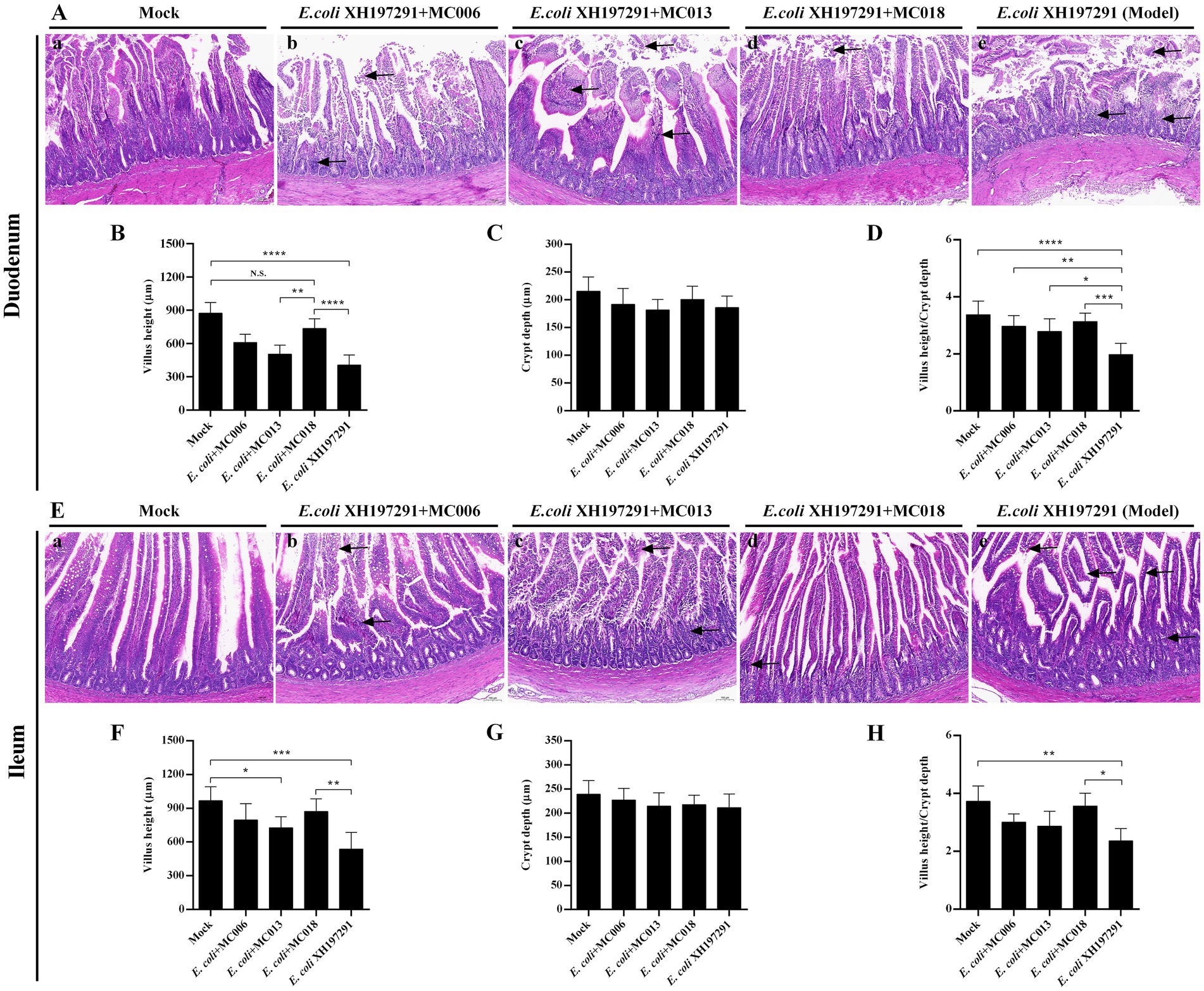 Histological and bar chart analysis of duodenum and ileum samples. Panels A-E show tissue sections with varying treatments: Mock, E. coli XH97291 with MC006, MC013, MC018, and model XH97291. Panels B, C, F, and G display bar graphs measuring villus height and crypt depth with comparisons indicated by asterisks. Panels D and H present villus height to crypt depth ratios. Significant differences are marked by asterisks, with asterisks denoting the level of significance.