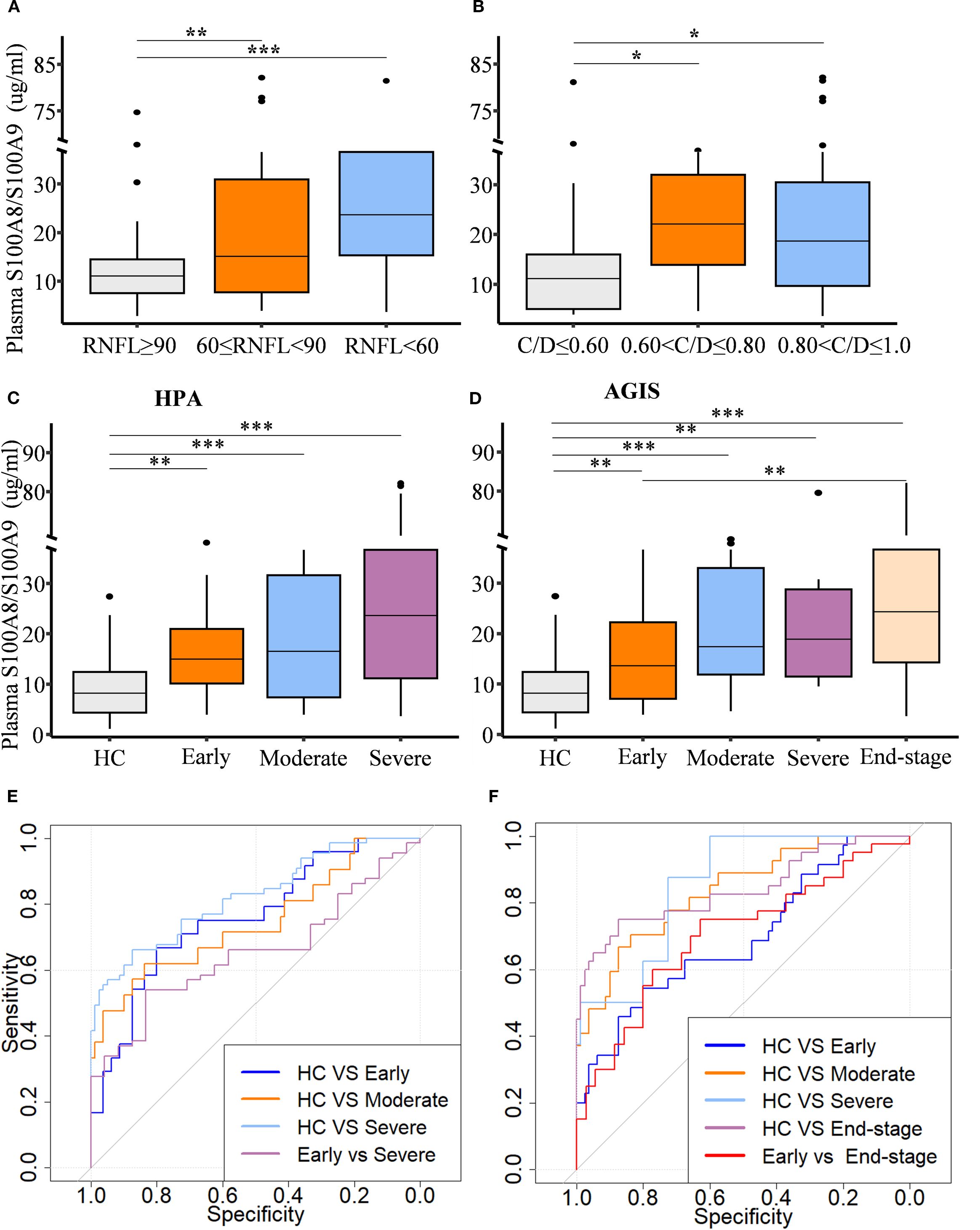 Graphs A to D show box plots of plasma S100A8/S100A9 levels in different groups, highlighting statistical significance with asterisks. Graph A compares levels across RNFL measurements, B amongst C/D ratios, C across HPA stages, and D across AGIS stages. Graphs E and F feature ROC curves illustrating sensitivity versus specificity for various comparisons, including HC versus different disease stages, with color-coded lines.