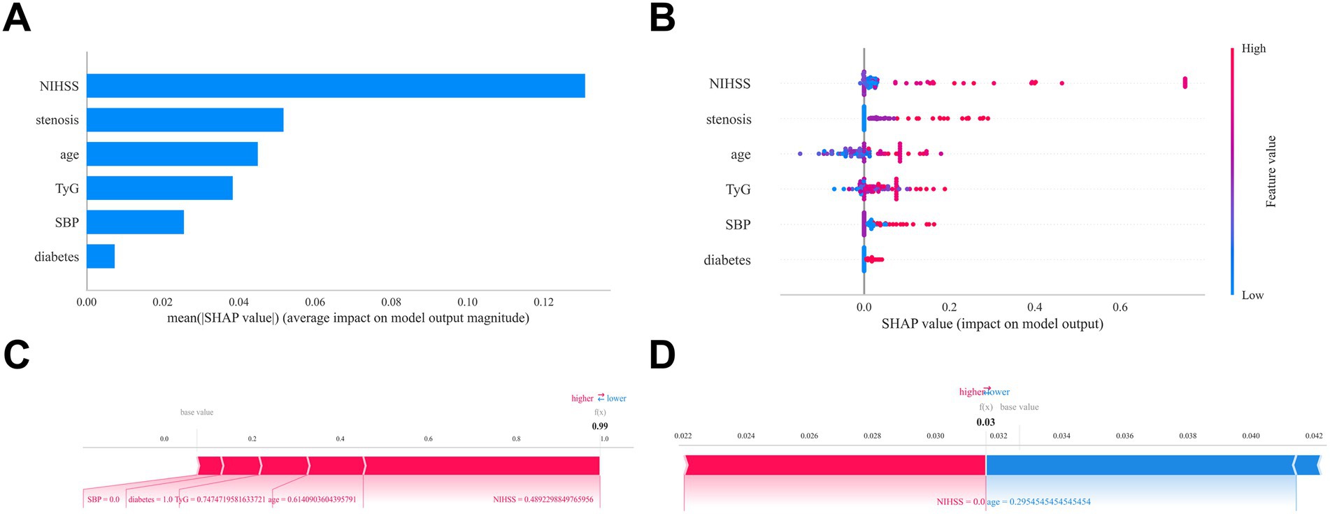 Chart A shows a bar graph of average SHAP values with NIHSS as the most impactful feature, followed by stenosis and age. Chart B is a scatter plot of SHAP values with NIHSS having the highest impact, and colors indicating feature values. Chart C and D depict SHAP waterfall plots. Chart C shows a high predicted outcome of 0.99, influenced by features like TyG and NIHSS. Chart D shows a lower prediction of 0.03, influenced by NIHSS and age. Both feature color gradients from pink to blue, indicating influence direction.