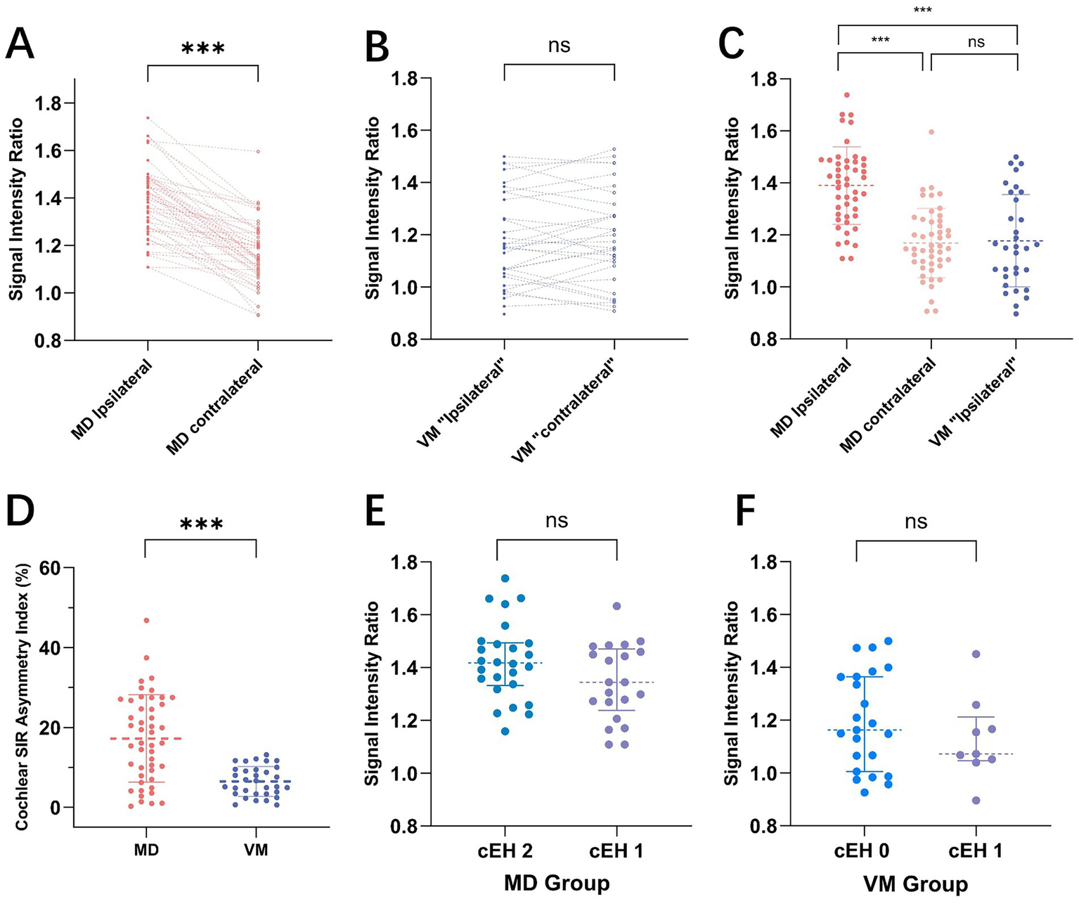 Six scatter plots compare signal intensity ratios and cochlear asymmetry indexes across different groups and conditions. A: MD group shows significant difference between ipsilateral and contralateral (***). B: VM group shows no significant difference (ns). C: Comparison of MD and VM groups reveals significant differences between MD ipsilateral and contralateral (***), and VM ns. D: Cochlear asymmetry index shows significant difference between MD and VM (***). E: cEH 2 and cEH 1 in MD group show no significant difference (ns). F: cEH 0 and cEH 1 in VM group show no significant difference (ns).