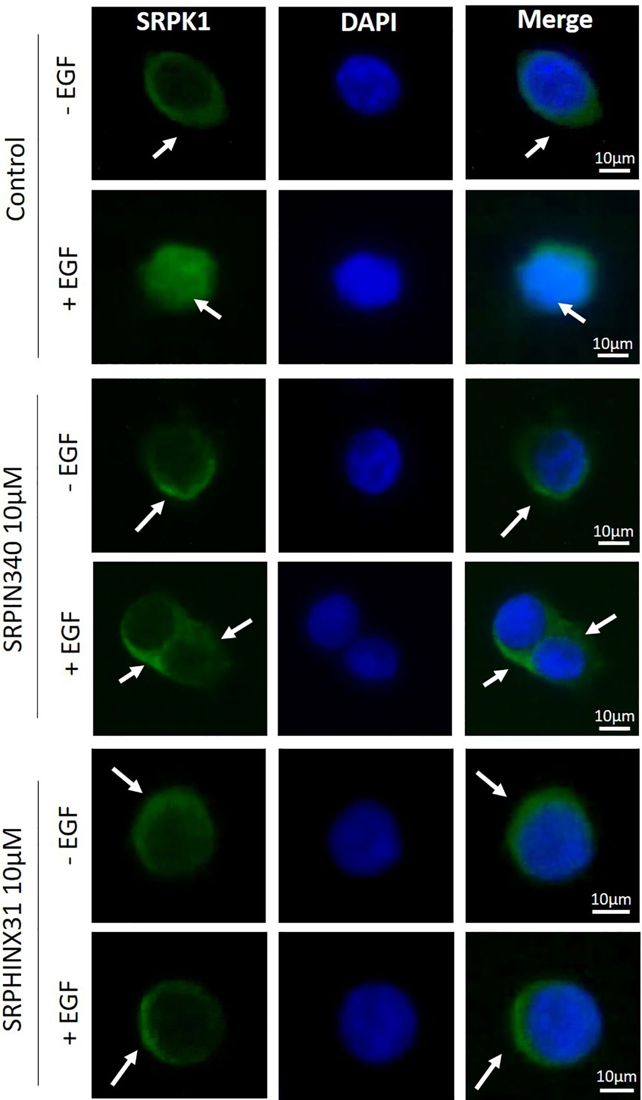 Fluorescence microscopy images showing cellular localization of SRPK1 with various treatments. The first column displays SRPK1 staining in green, the second shows DAPI in blue, and the third shows the merged images. Rows are categorized by treatment: Control, SRPIN340 10µM, and SRPINX31 10µM, with and without EGF. Each row compares contrast between conditions, highlighting differences in cellular localization. Scale bars indicate 10 micrometers.