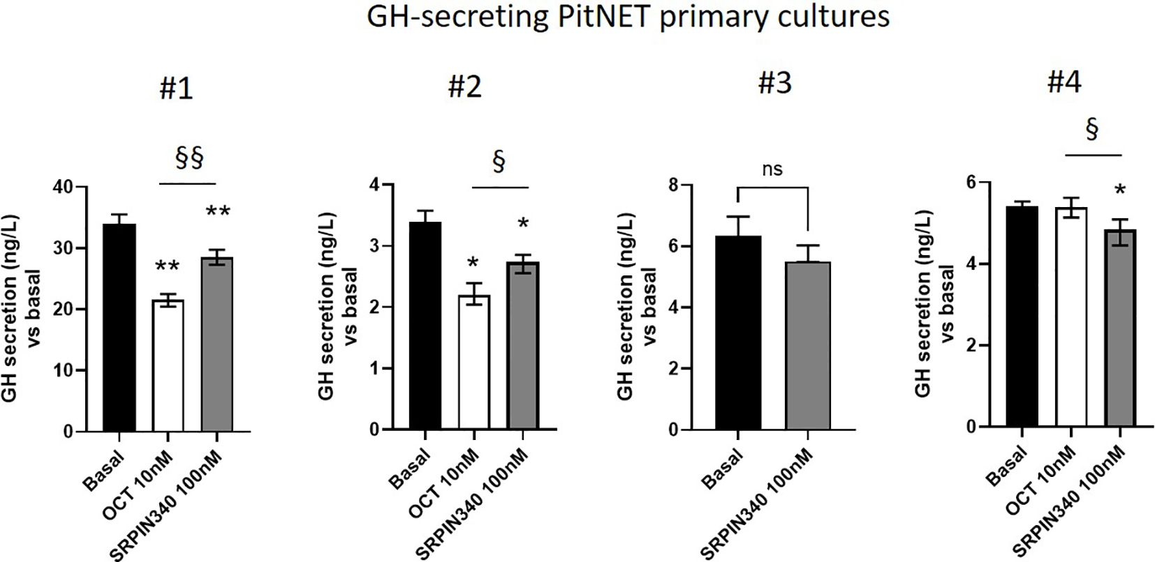 Bar graphs depict growth hormone secretion levels in GH-PitNET primary cultures from 4 different tumors (#1 to #4). Each graph compares basal, OCT 10 nanomolar, and SRPIN340 100 nanomolar treatments. Significant differences in secretion levels versus basal conditions are marked with asterisks, indicating statistical significance across conditions, with §§ and § symbols marking varying levels of significance between treatment groups.