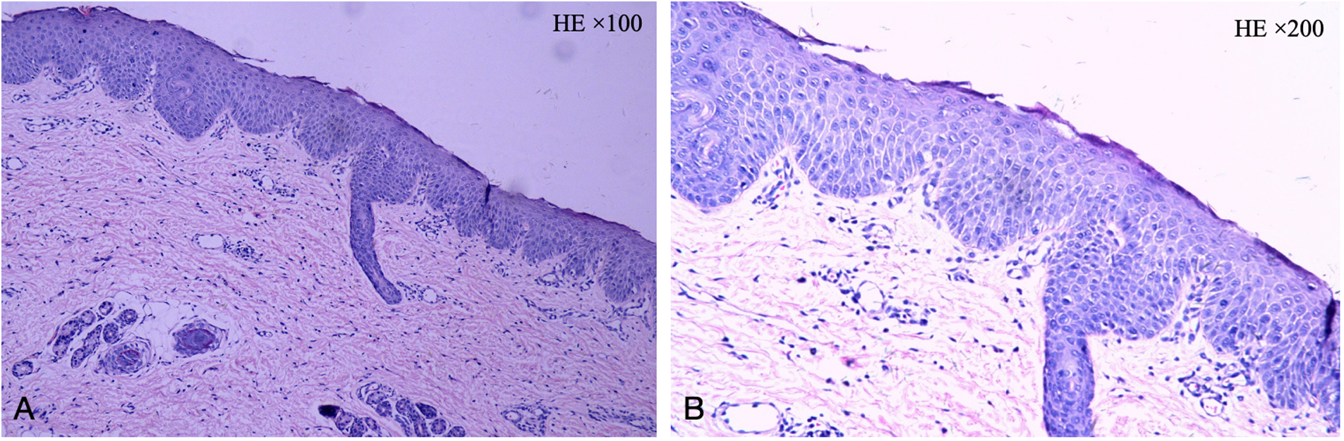Histological images showing skin tissue at two different magnifications. Image A is at one hundred times magnification, displaying a cross-section of epidermal and dermal layers with visible hair follicles. Image B is at two hundred times magnification, providing a closer view of epidermal cells. Stained in purple-blue with hematoxylin and eosin.