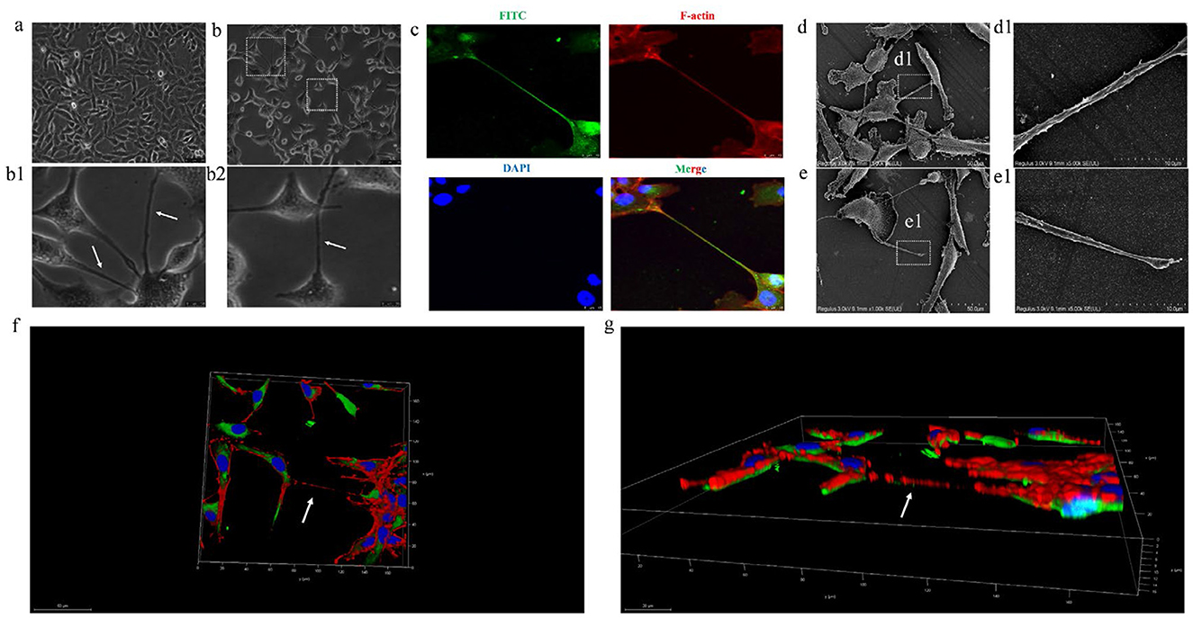 Microscopic images display cell observations in various stages. Panels (a) and (b) show cells with highlighted structures in close-ups (b1, b2). Panel (c) presents fluorescence images with FITC and F-actin staining. Panel (d) shows cells with focus areas (d1), and panel (e) with another focus (e1), captured in surface detail. Panels (f) and (g) depict 3D renderings, highlighting cellular structures using colors red, green, and blue. Arrows in each panel emphasize specific features or connections.