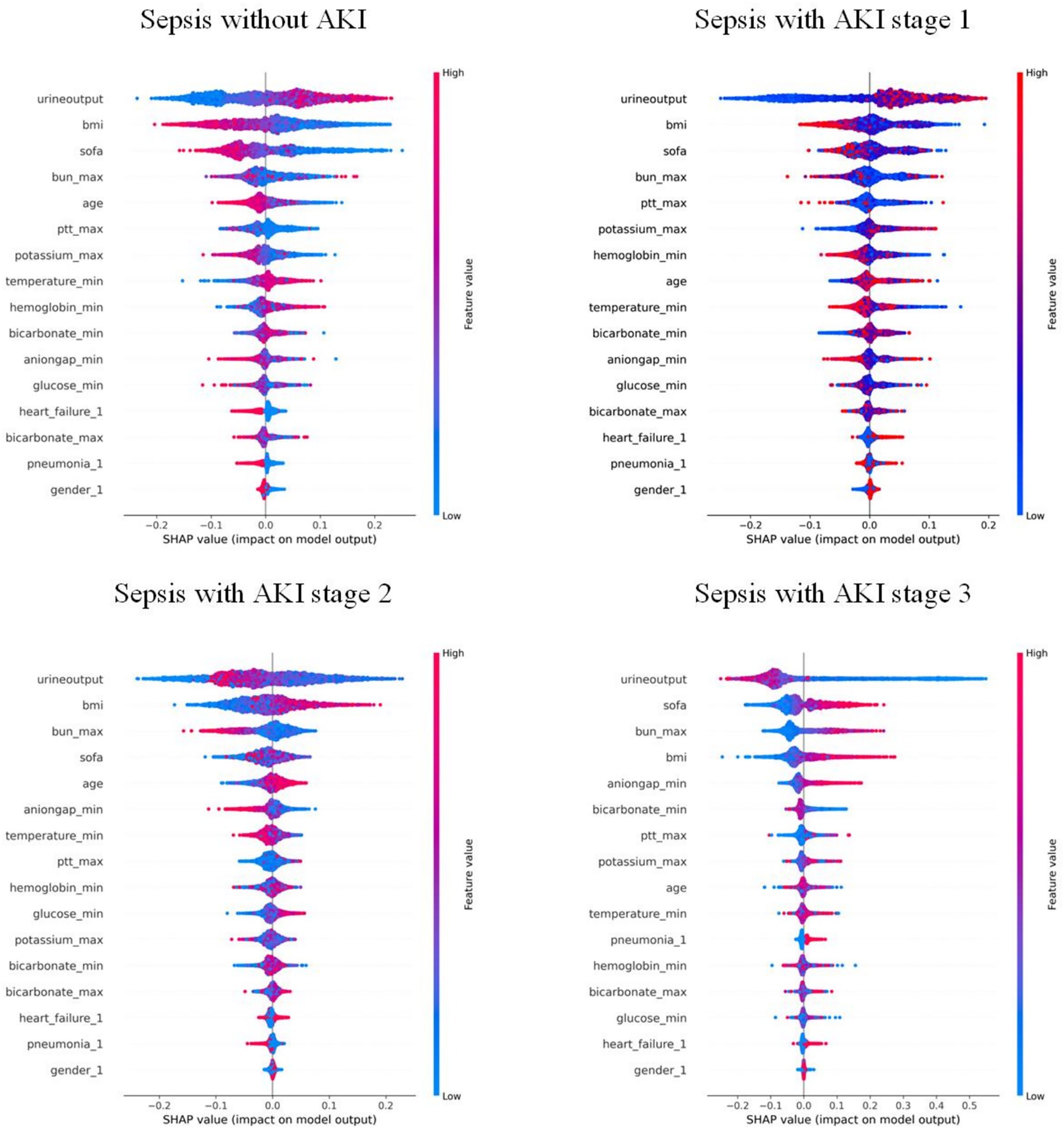 Four SHAP value plots compare feature impacts on model output for sepsis patients with different acute kidney injury (AKI) stages. Each plot includes features like urine output and body mass index, with color bars indicating high (red) to low (blue) feature values. The plots are labeled as