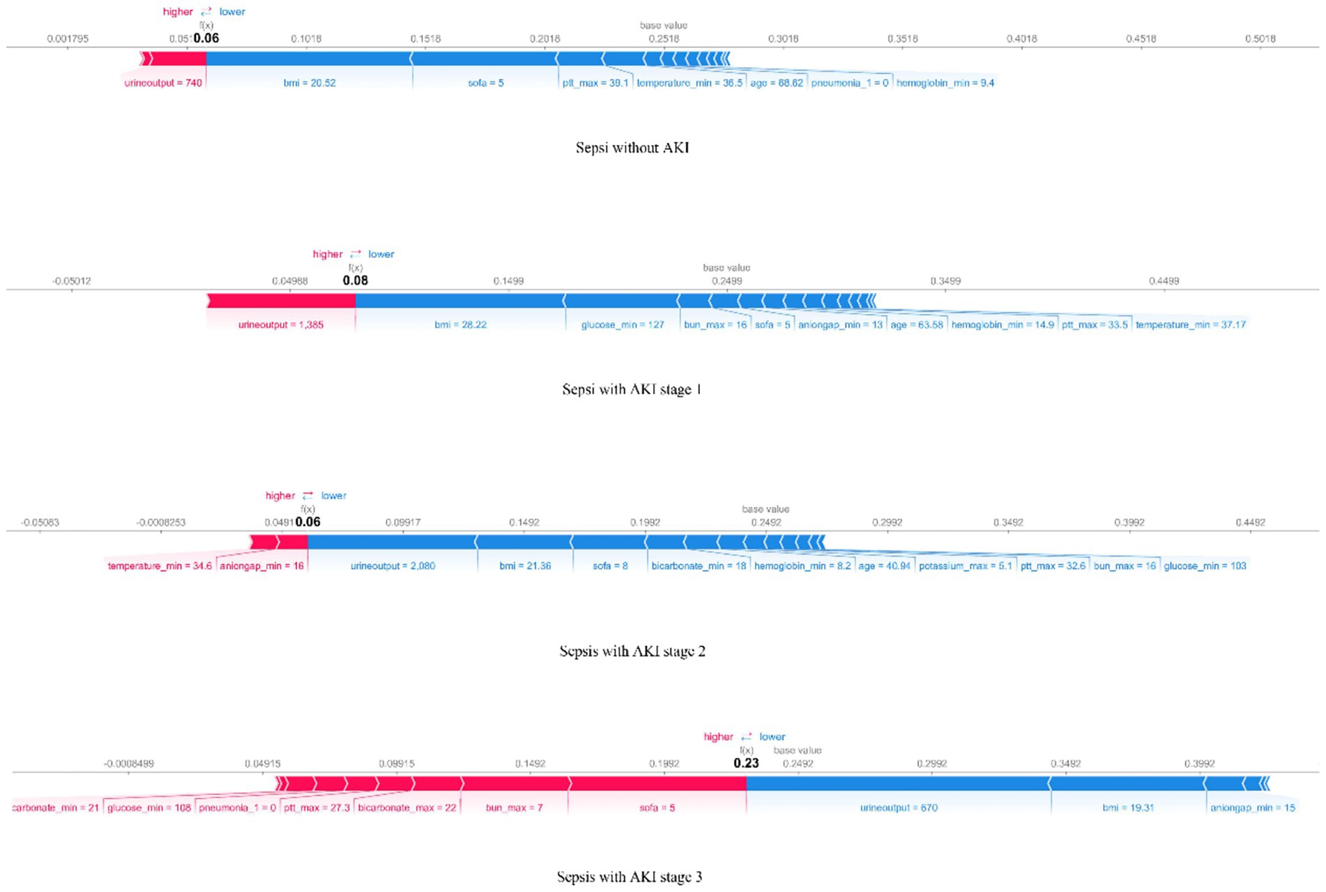 Three waterfall charts display SHAP values for sepsis patients with different AKI stages. The first chart shows