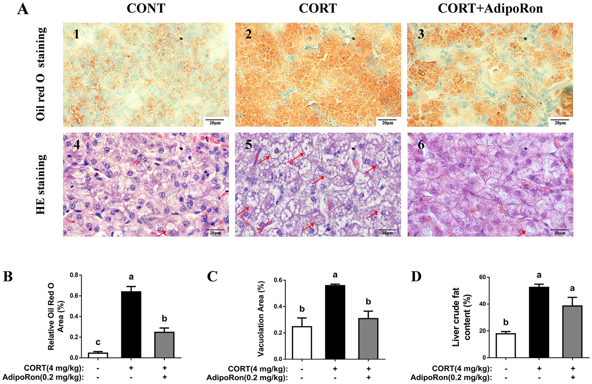 Histological analysis and related bar graphs from an experiment with three groups: CONT, CORT, and CORT+AdipoRon. Panels 1 to 3 show Oil Red O staining; panels 4 to 6 show H&E staining. Arrows in panels 5 and 6 indicate vacuolation. Graphs B to D display quantitative data: Oil Red O area, vacuolation area, and liver crude fat content, respectively, comparing the effects of treatments with letters indicating statistical significance.